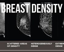 Breast-cancer-screening_breast-density_myEmma-thumbnail.jpg