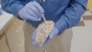 Allen-Institute_Human-Brain-Dirk-Keene_1col.jpg